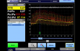 High Rate of Residual Ischemia After PCI Despite Excellent Angiographic Outcomes: DEFINE-PCI 